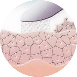 mikroderma-2.jpg