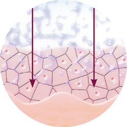 mikroderma-3.jpg